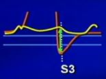Advanced Cardiac Examination Techniques Quiz - Quiz