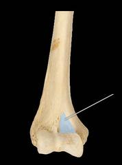 Appendicular Skeleton - Quiz