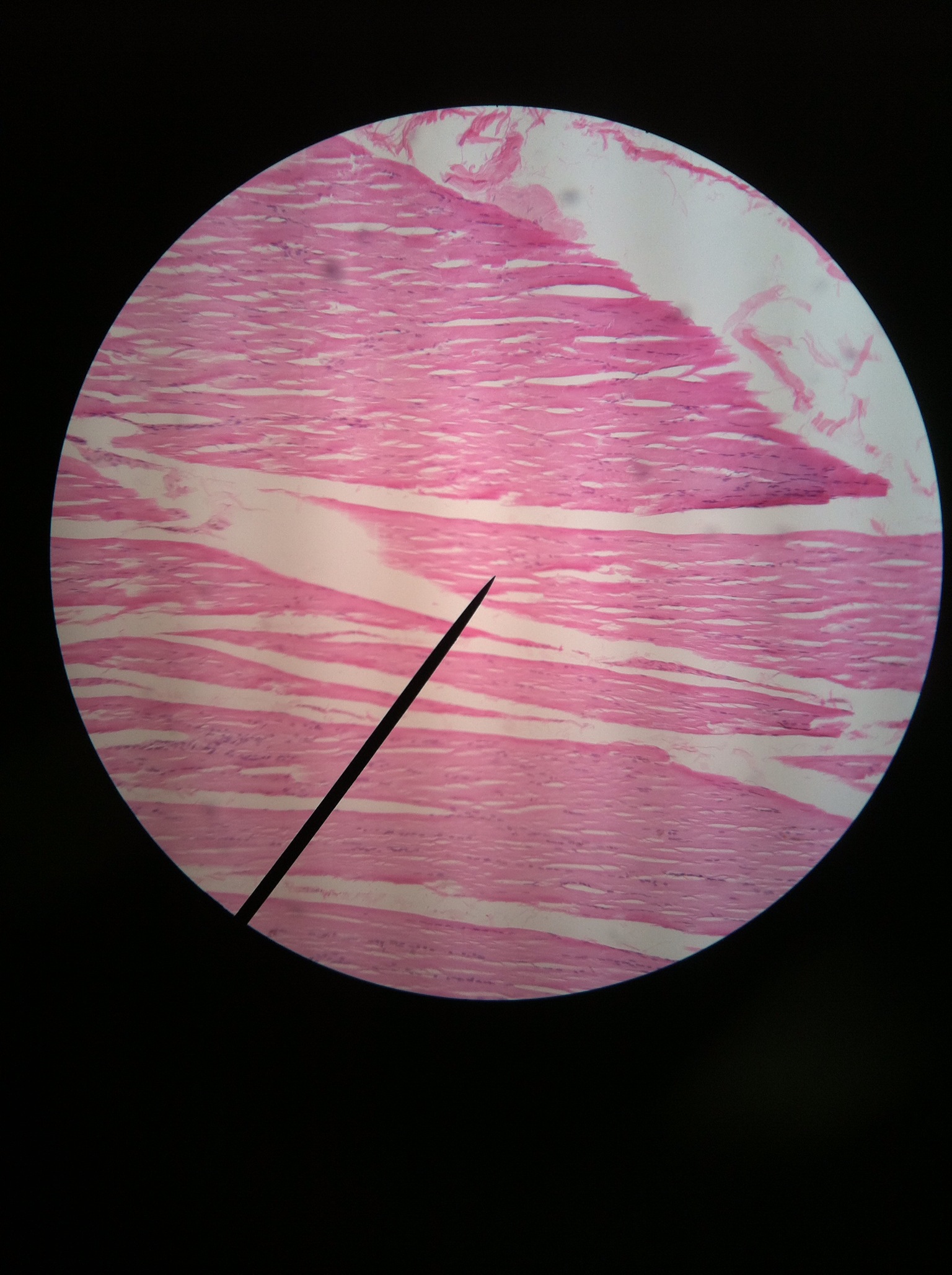 Human Epithelial Tissue Types and Functions Quiz - Quiz