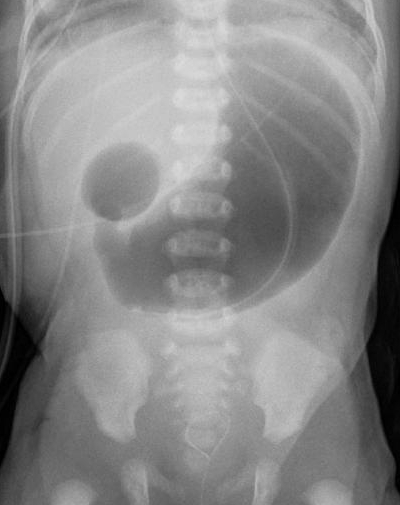 GI Anatomy/Embryology/Physiology - Quiz