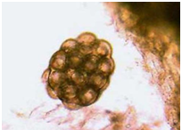Cestodes Tapeworms Quiz: Parasitic Worms - Quiz, Flashcards & Trivia
