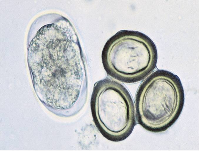 Cestodes Tapeworms Quiz: Parasitic Worms - Quiz, Flashcards & Trivia