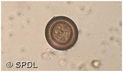 Cestodes Tapeworms Quiz: Parasitic Worms - Quiz, Flashcards & Trivia