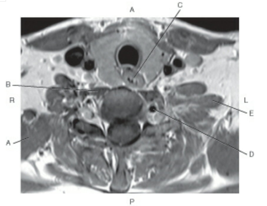 Identify Arrow Point Of MRI! - Quiz