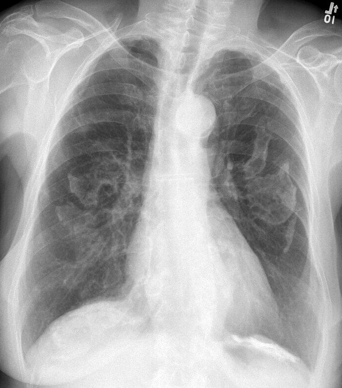 Medical Term Quiz Questions Part - 10 - Quiz