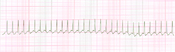 Protocol Knowledge Exam (Intermediate/Paramedic) - Quiz