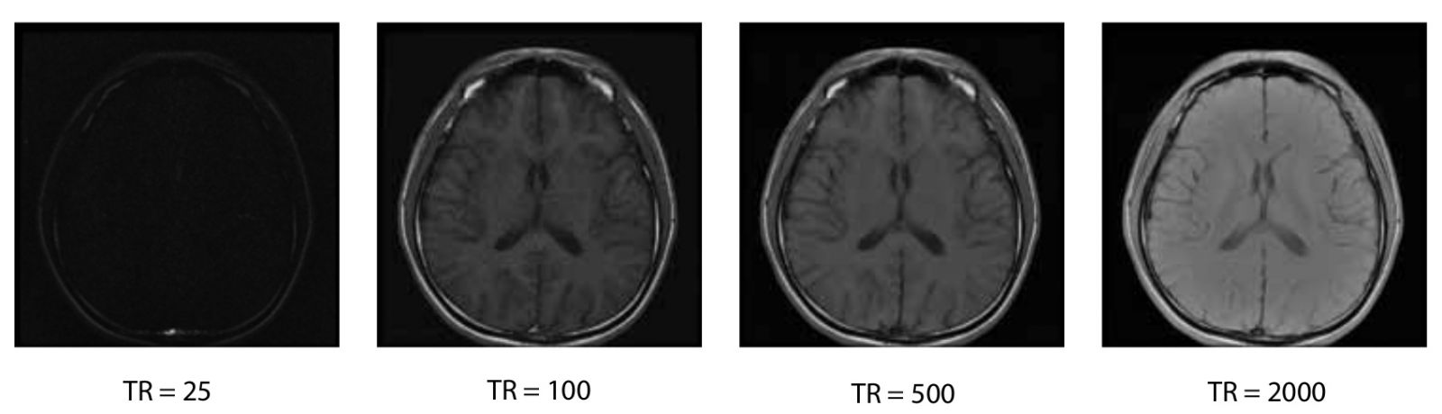 The top row of images is acquired with TE=10ms