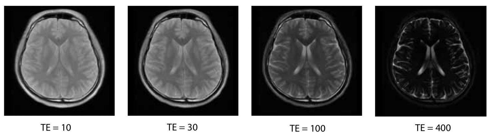 The bottom row of images is acquired with TR=4000ms