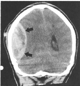 Cranial Cavity Anatomy Quiz: Brain and Structures - Quiz
