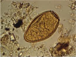 Trematodes Parasites Quiz: Flukes and Life Cycles - Quiz
