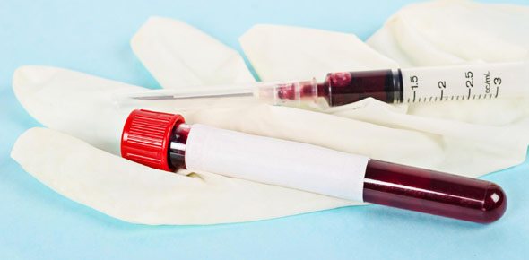 Serology Quizzes & Trivia