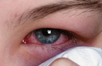 Do I Have Allergies? - ProProfs Quiz