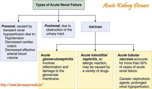 What Do You Know About Acute Renal Failure Proprofs Quiz