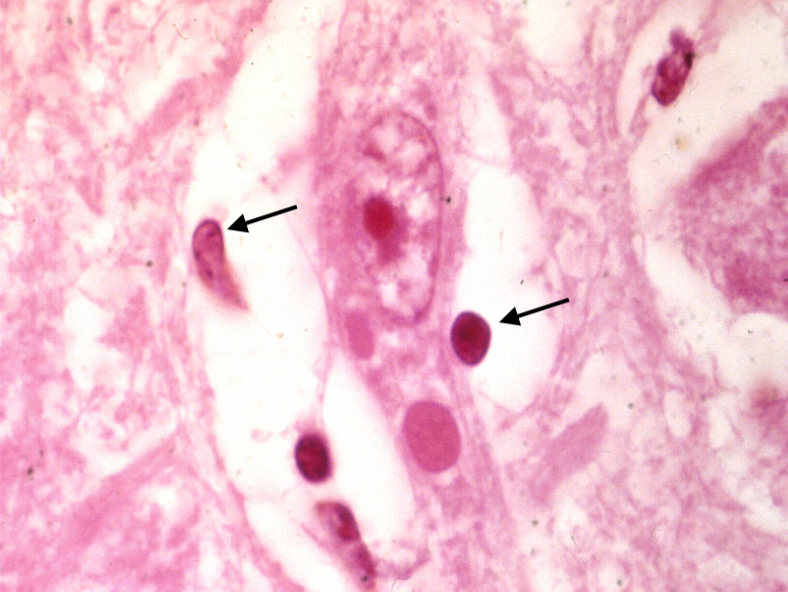 clostridium perfringens hund