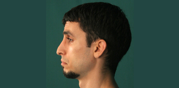 What emotion is this?
 - ProProfs