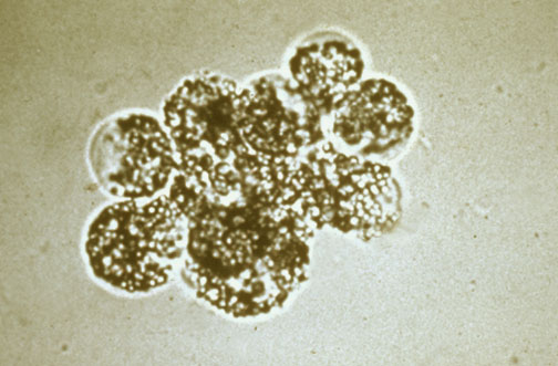 Urinalysis Pictures