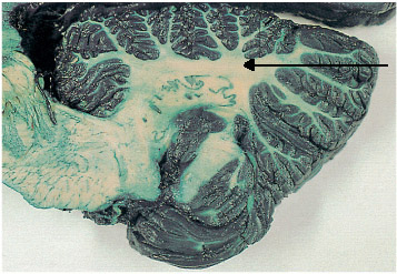 Cerebellum Locate