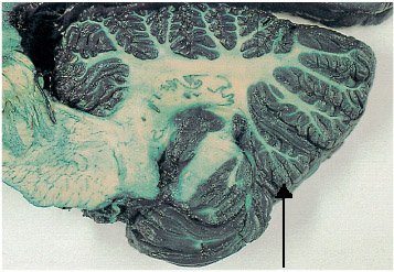 Cerebellum_Locate