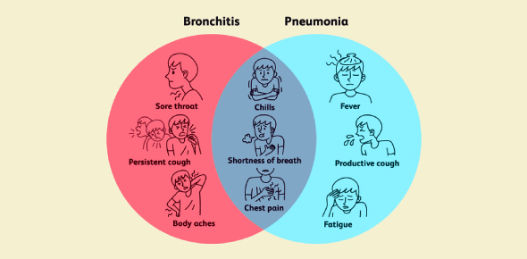 Bronchitis and pneumonia are caused by inflammation of the lungs. Bronchitis is more often viral, Bronchitis and pneumonia are caused by inflammation of the lungs. Bronchitis is more often viral,